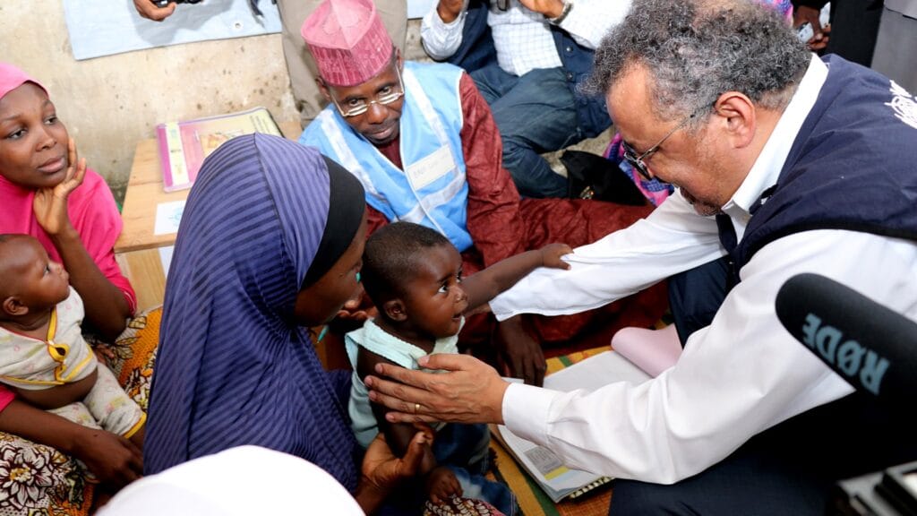 dr-tedros tending to a child in-nigeria 
